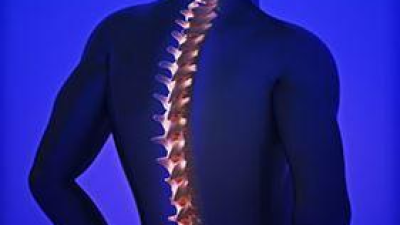 Chirurgia della schiena, come “tornare” a nuova vita