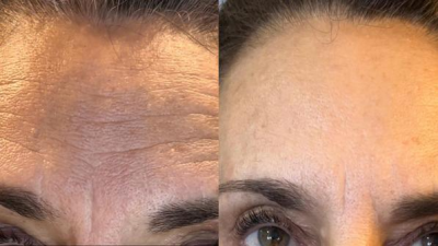 L’estetica rigenerativa per chi sceglie di rimanere sé stessa